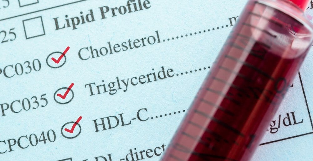 Triglycérides élevés : 4 méthodes pour faire baisser un taux excessif